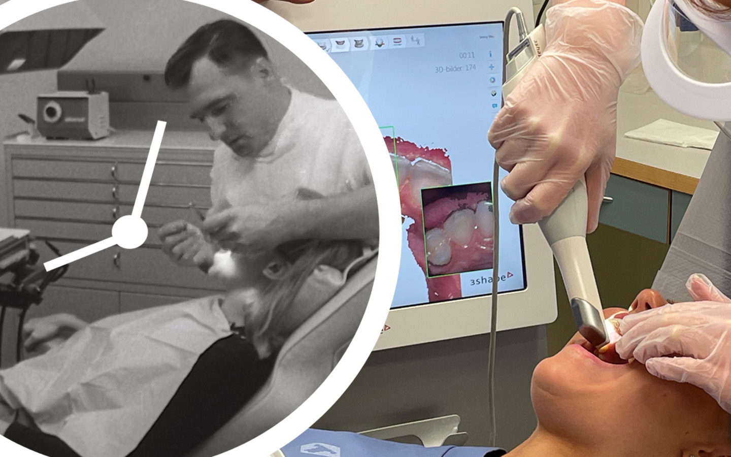 Split image of a black and white dentist from the last century framed by a clock to illustrate time travel, plus a color image depicting a 3D scan of teeth using modern technology.