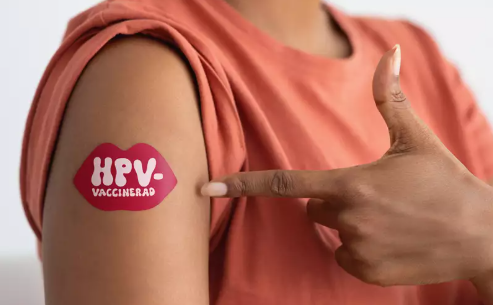 Region Västernorrland har nått en täckningsgrad på 60 procent för HPV-vaccination i länet. 